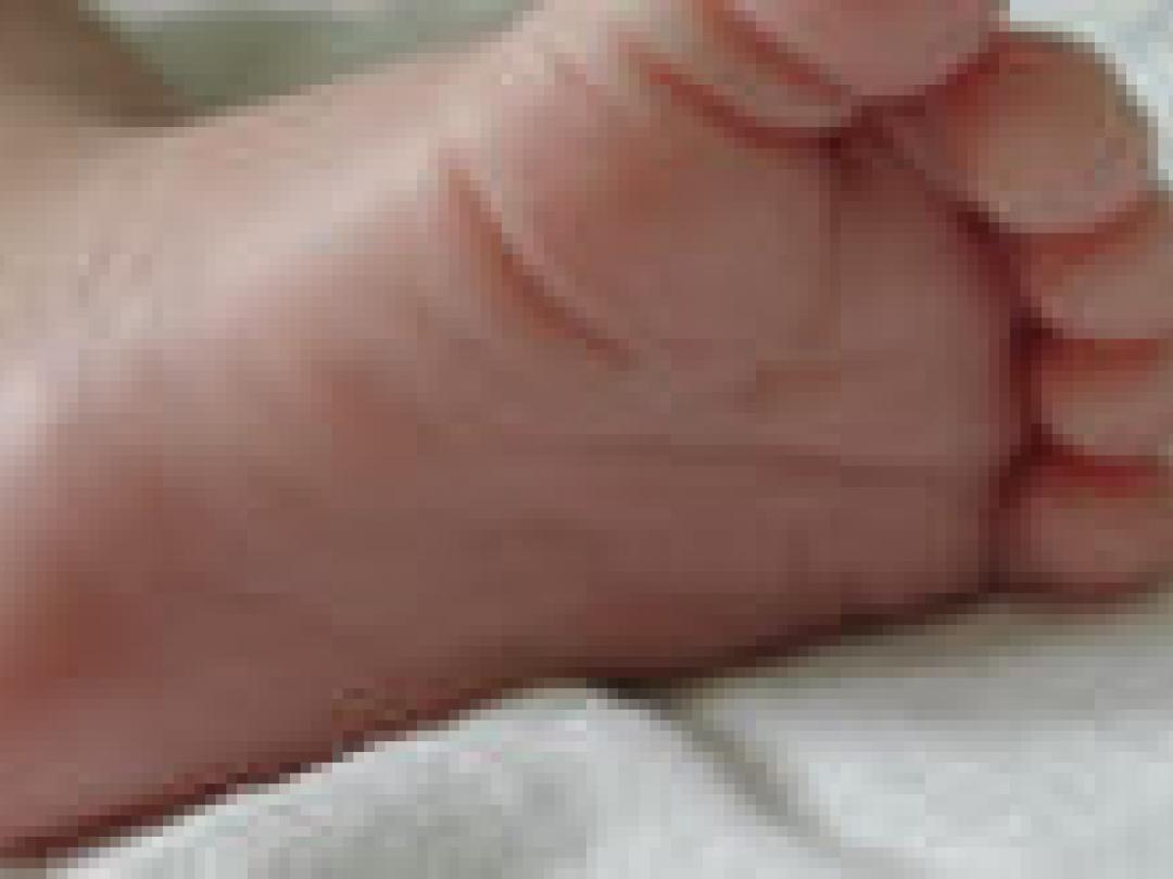 Hielprikscreening taaislijmziekte vanaf 1 mei 2011