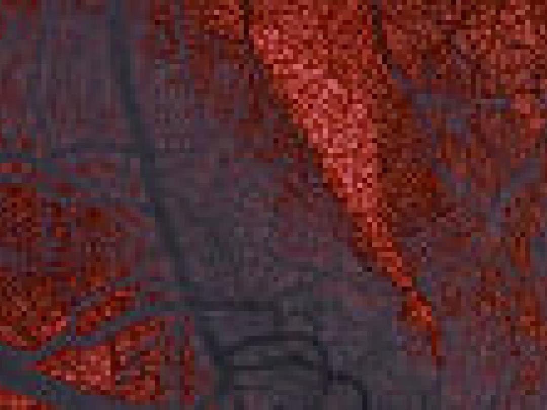 Beeldvorming asymptomatisch coronairlijden: tegenstrijdige richtlijnen