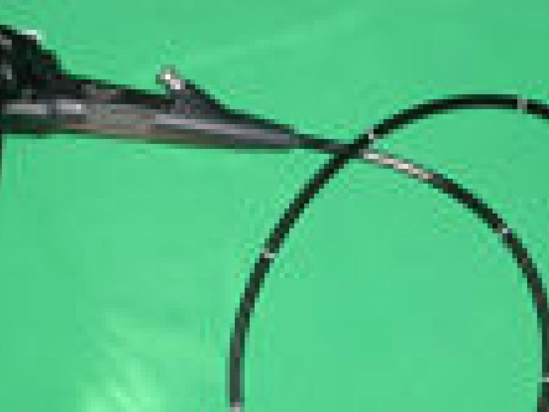 Effect van endoscopie door verpleegkundigen