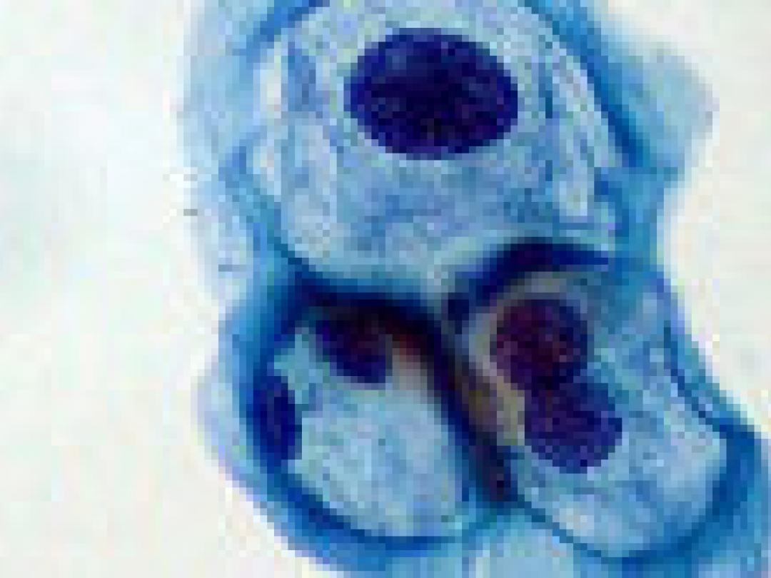 Studie steunt Nederlands bevolkingsonderzoek baarmoederhalskanker