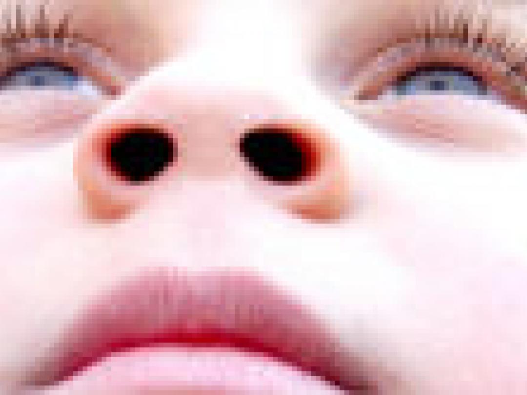 Overlevers kinderkanker hebben verhoogd risico op nieuwe tumoren