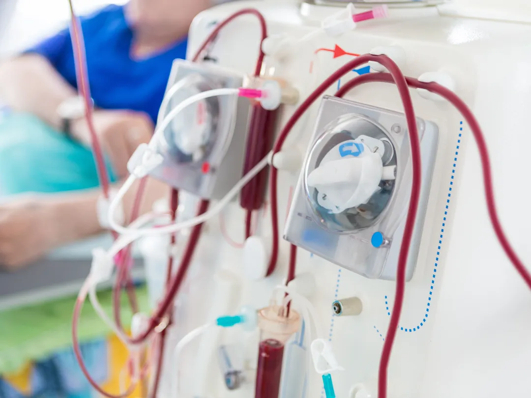 Een dialysemachine.