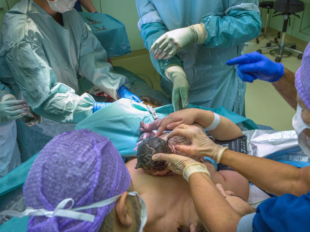 Een pasgeboren kind wordt op de borst van de moeder gelegd.