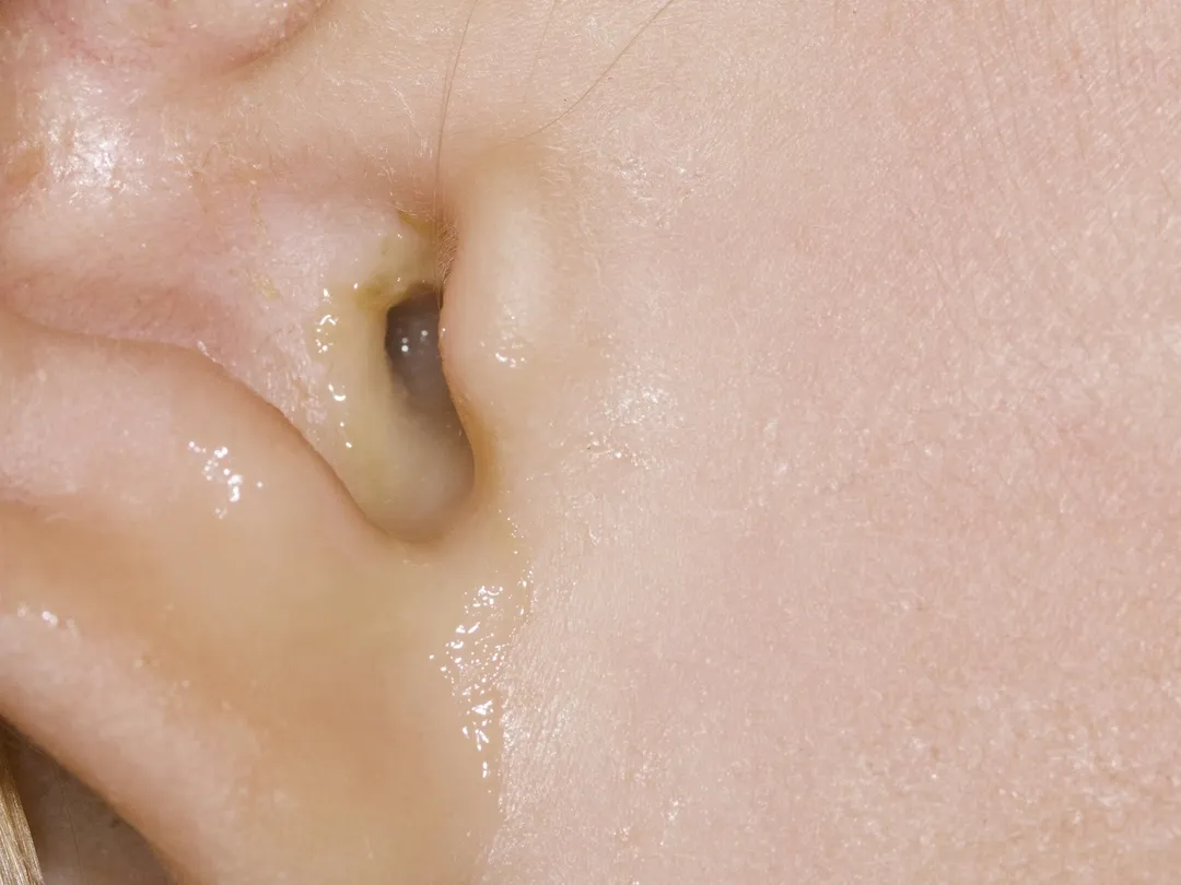 Close-up van een loopoor.