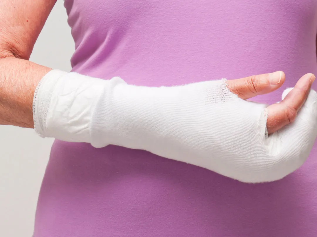 Een arm in het gips.