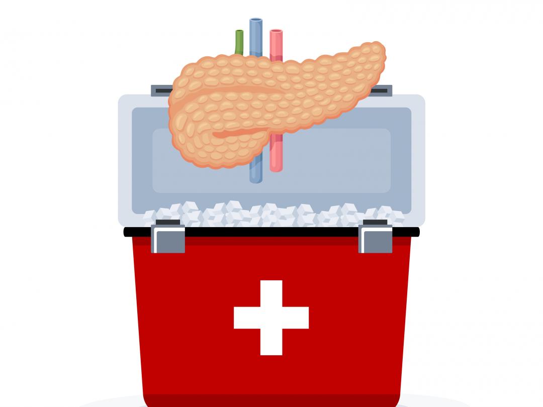 Tekening van pancreas in donorcoolbox
