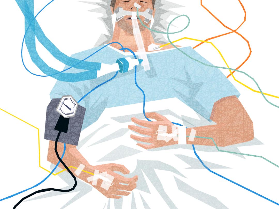 Illustratie van een patiënt gekoppeld aan infusen en beademing