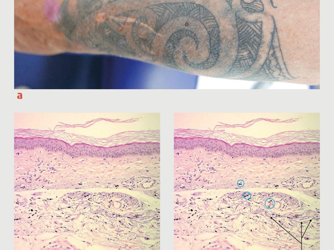 Arm met een tatoeage