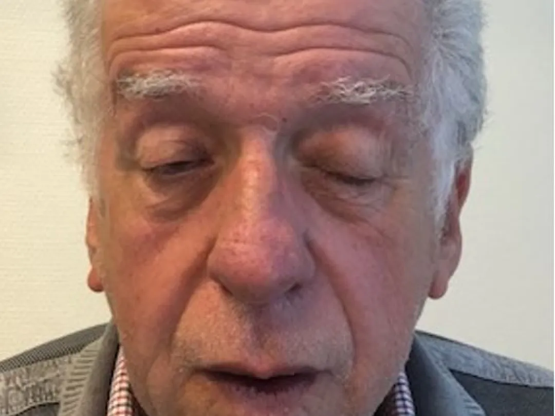 man met hangende oogleden.