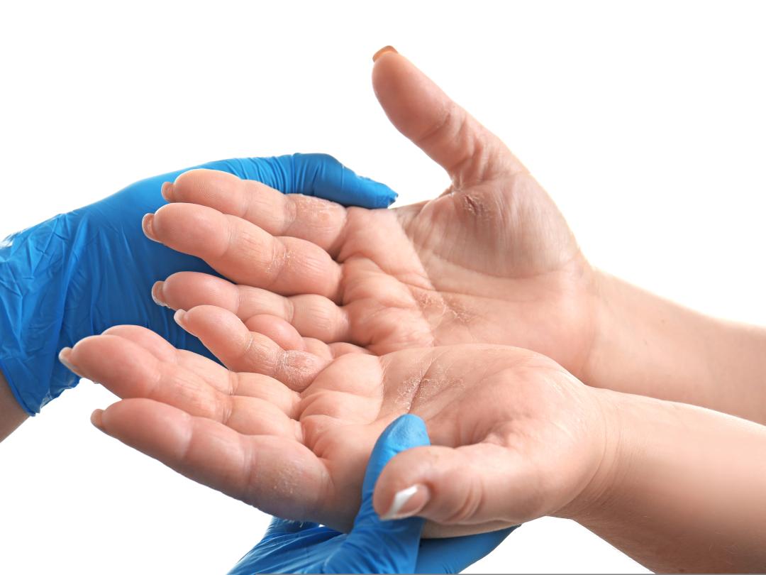 Chirurgische handen houden blote handen vast