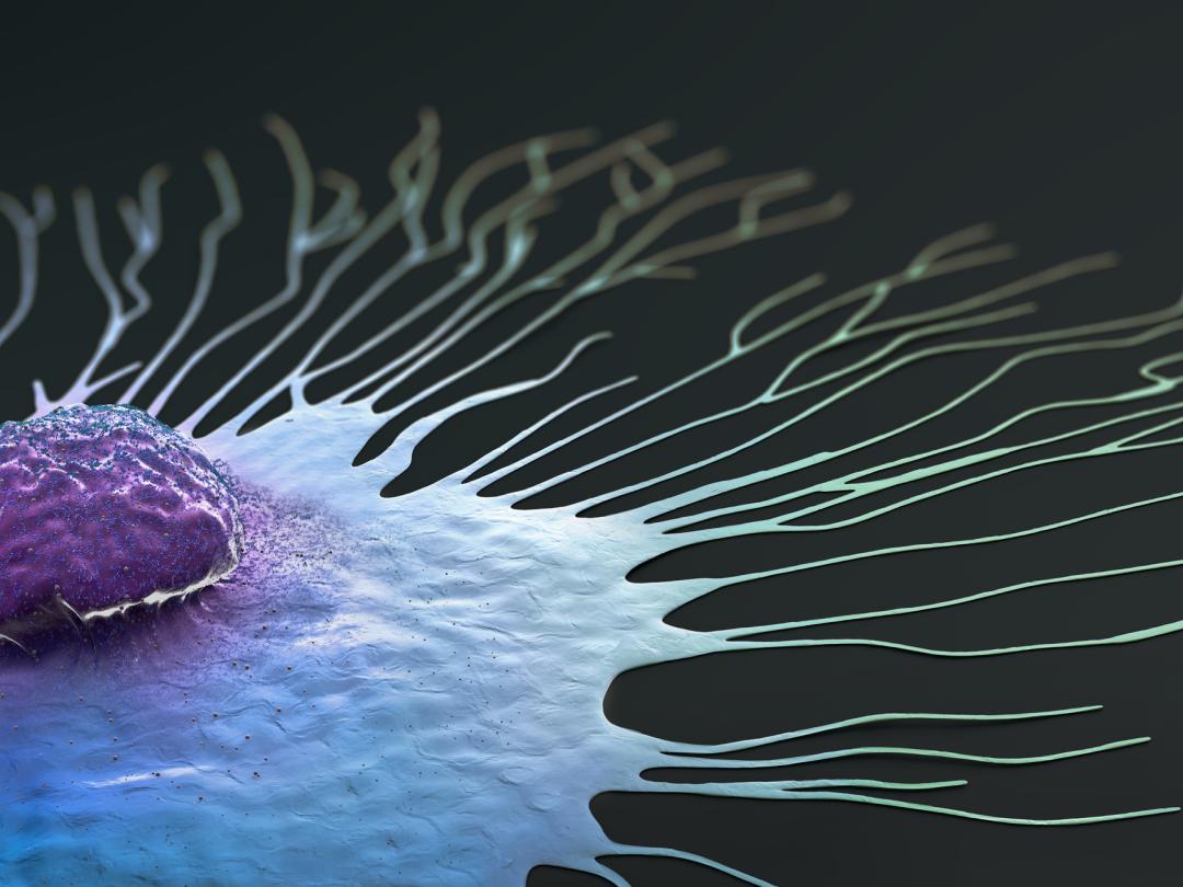 Microscopisch beeld van kanker