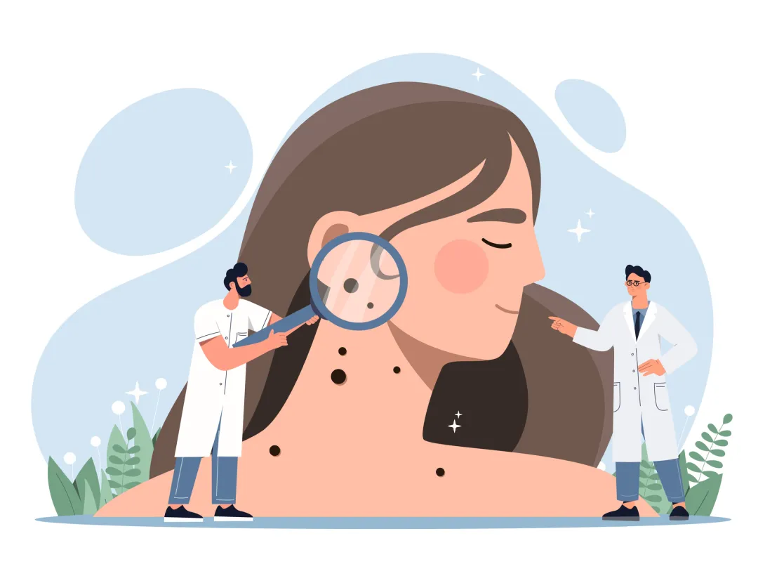 Illustratie van een dokter die een vergrootglas houdt bij de huid van de patiënt 