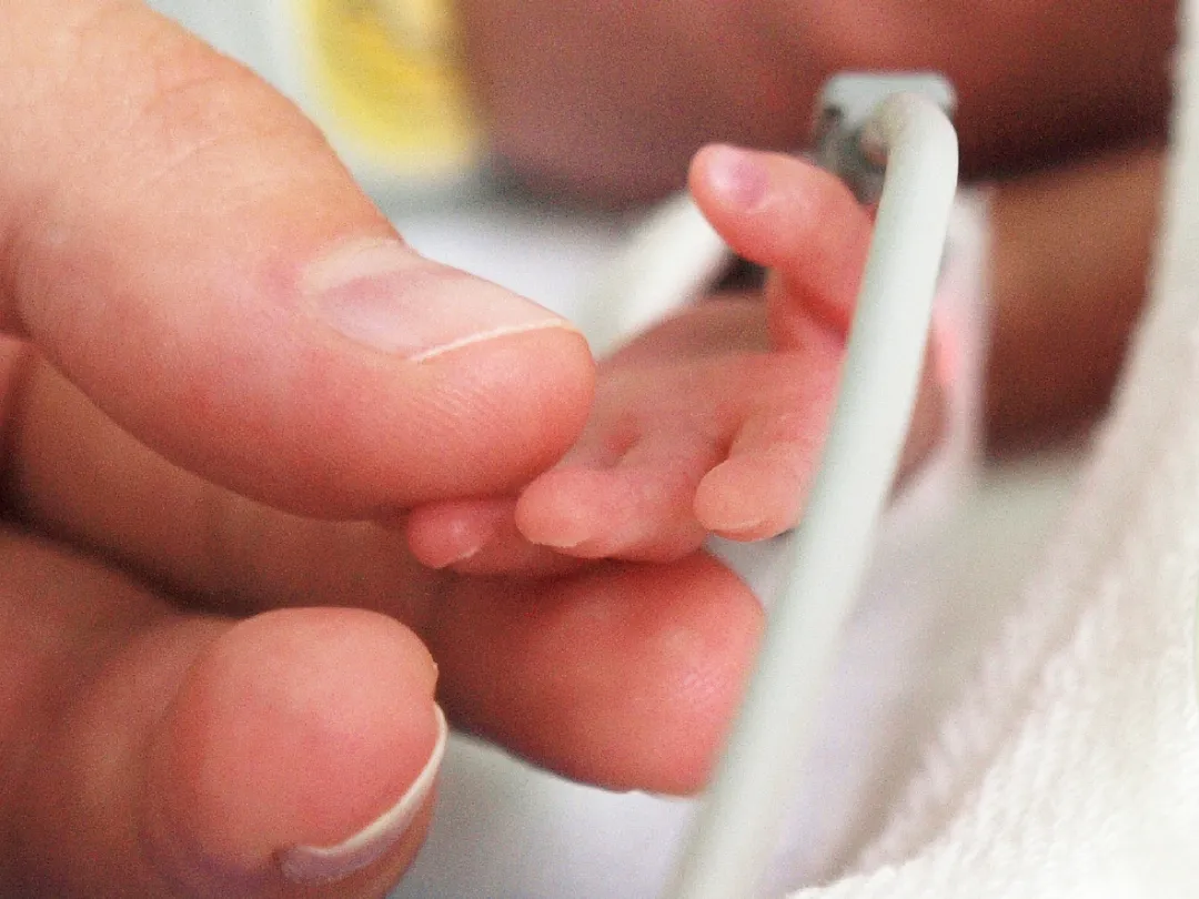Moeder en vroeggeboorte baby eerste aanraking