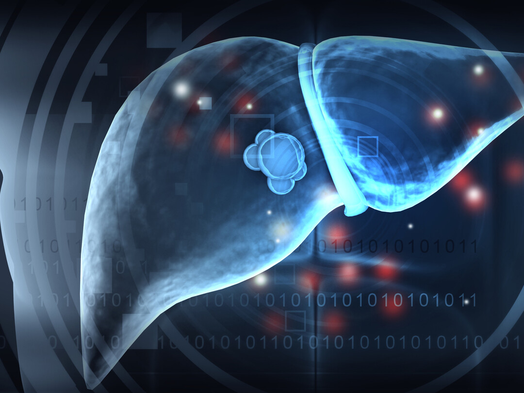 Illustratie van een lever met een tumor