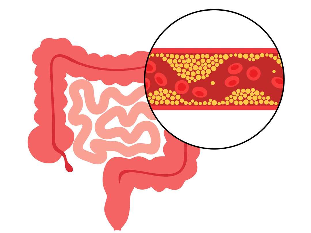 Illustratie van darmen