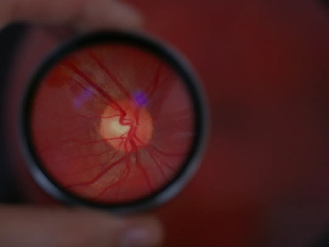 Close up van een oog