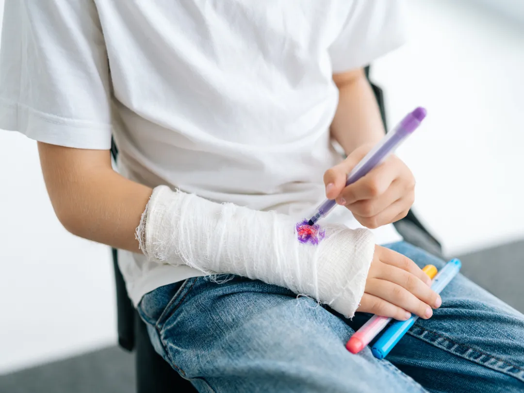 Iemand die tekent op zijn gips