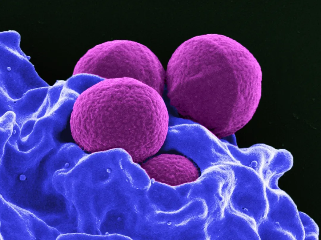 MRSA bacterie