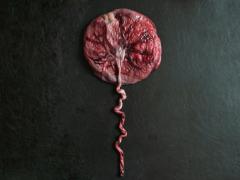 Een placenta.