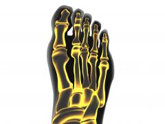 Calciumpyrofosfaat-artritis.