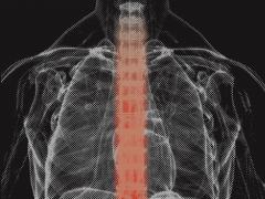 Cover van het proefschrift 'Optimizing locoregional control with radiotherapy in esophageal cancer' van Paul M. Jeene.