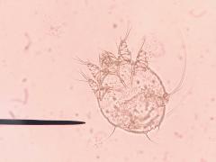 Microscopisch beeld van scabiës.