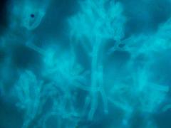 Microscopie van Aspergillus-draden.