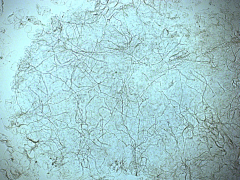 Schimmeldraden in KOH-preparaat.