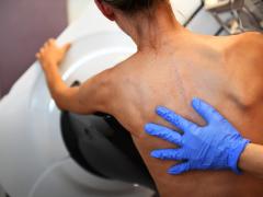 Een hand met een blauwe handschoen op een blote rug.