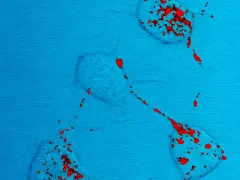 Foto: ANP Foto Prionziekten onder de microscoop.
