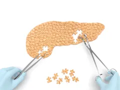Een paar handen werkt aan een puzzel in de vorm van een pancreas.