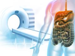 Illustratie van een scan apparaat samen met een lichaam waarin darmen te zien zijn