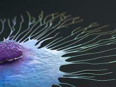 Microscopisch beeld van kanker