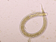 Strongyloides stercoralis