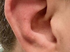 Oorschelp met afwijking