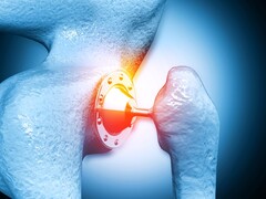 Illustratie van het kogelgewricht van de schouder