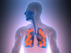 Illustratie van longen met een aandoening