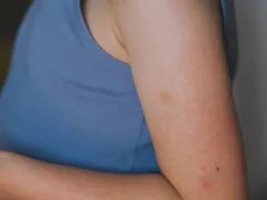 Meisjesarm