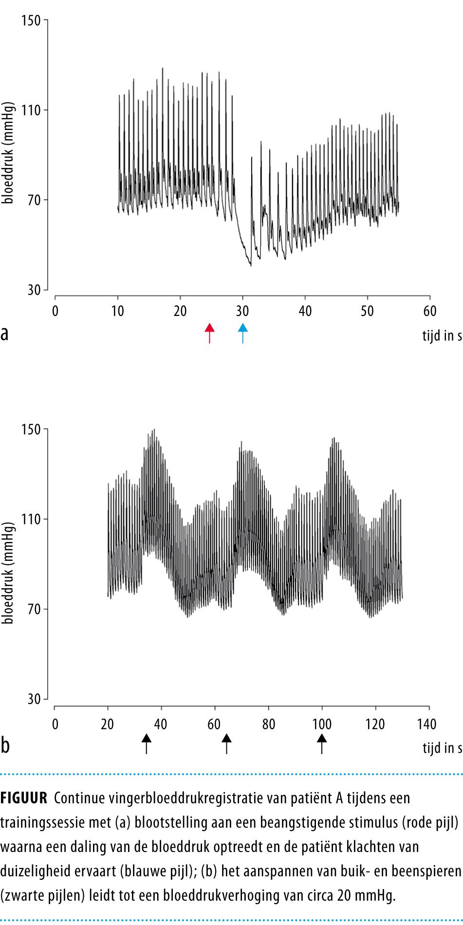 Het voorkómen van flauwvallen door naalden