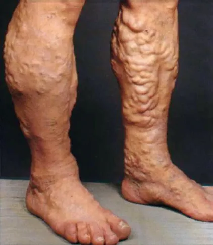Figuur 1
