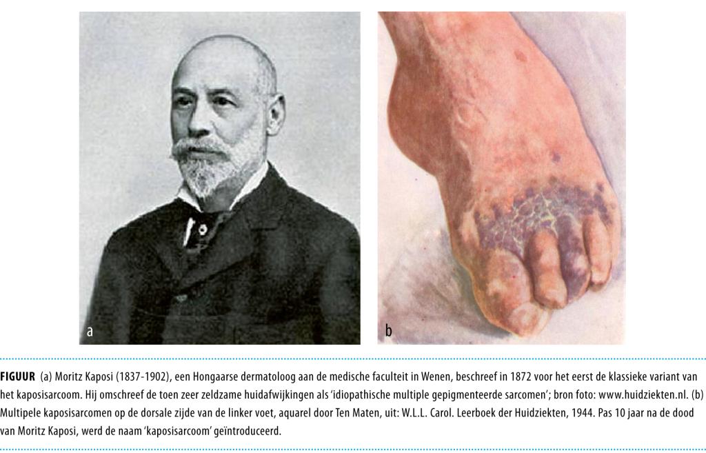 Moritz Kaposi en zijn sarcoom NTVG