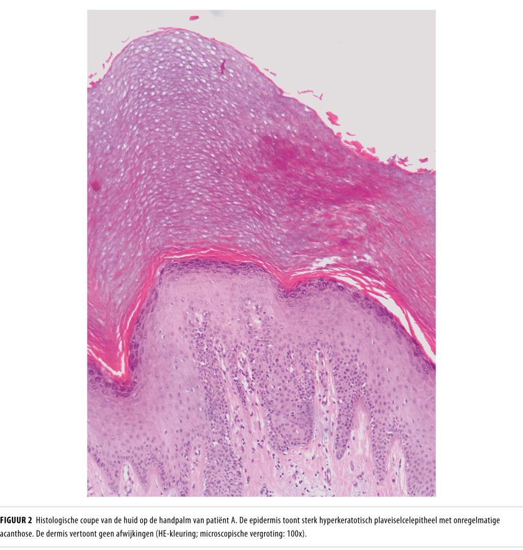 Neovaginaning fotosurati