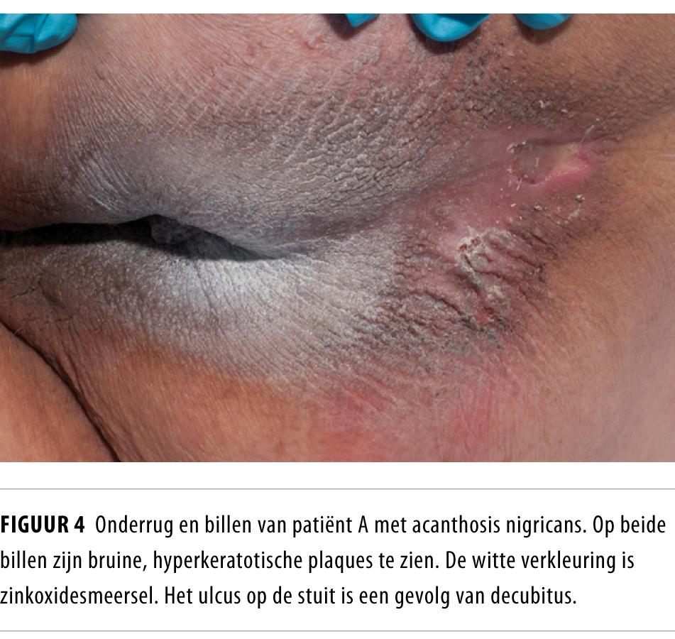 Sochida jinsiy aloqa uchun suhbat