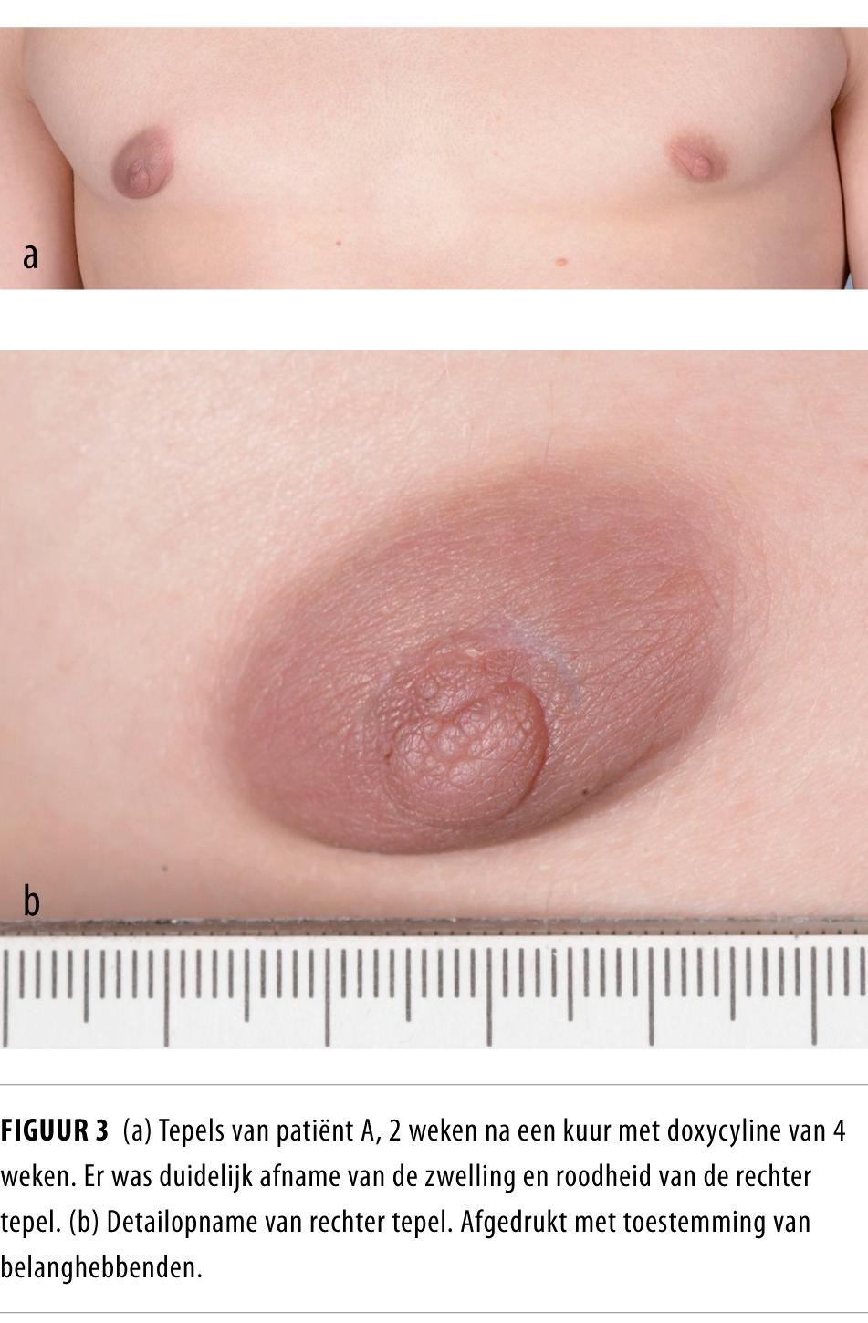 Oq xalatdagi shahvoniy sargish hamshira