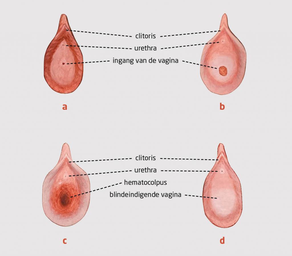 Figuur 1 | Inspectie van de vrouwelijke genitalia externa