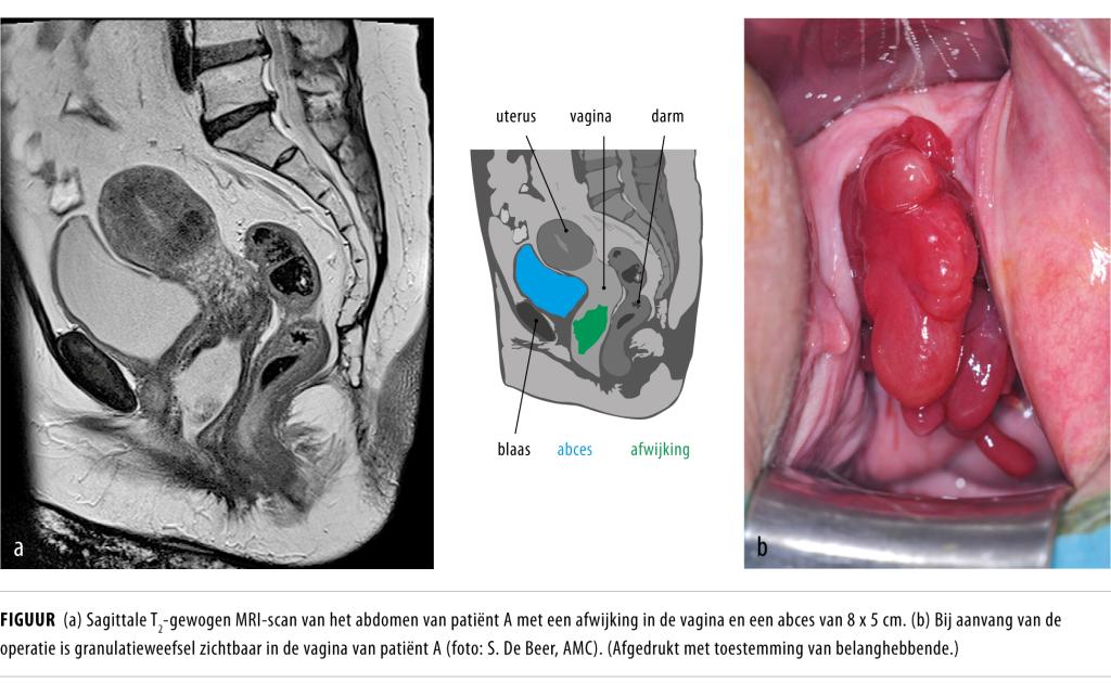 Ikki yigit bilan ajoyib jinsiy aloqa