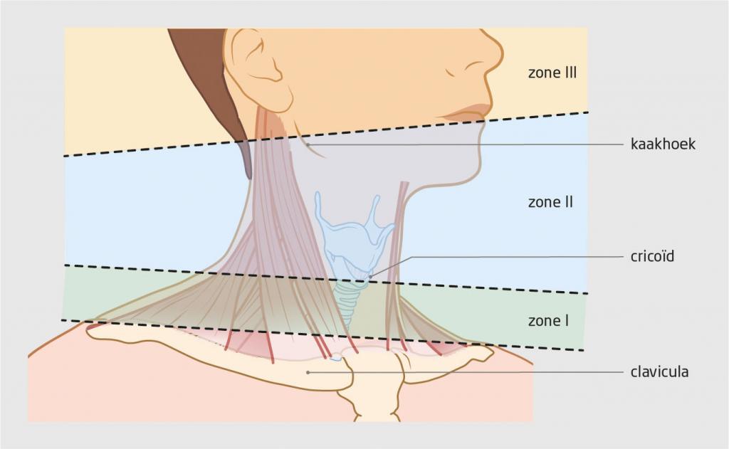 Figuur 1 | De hals onderverdeeld in 3 zones voor classificatie van penetrerend letsel