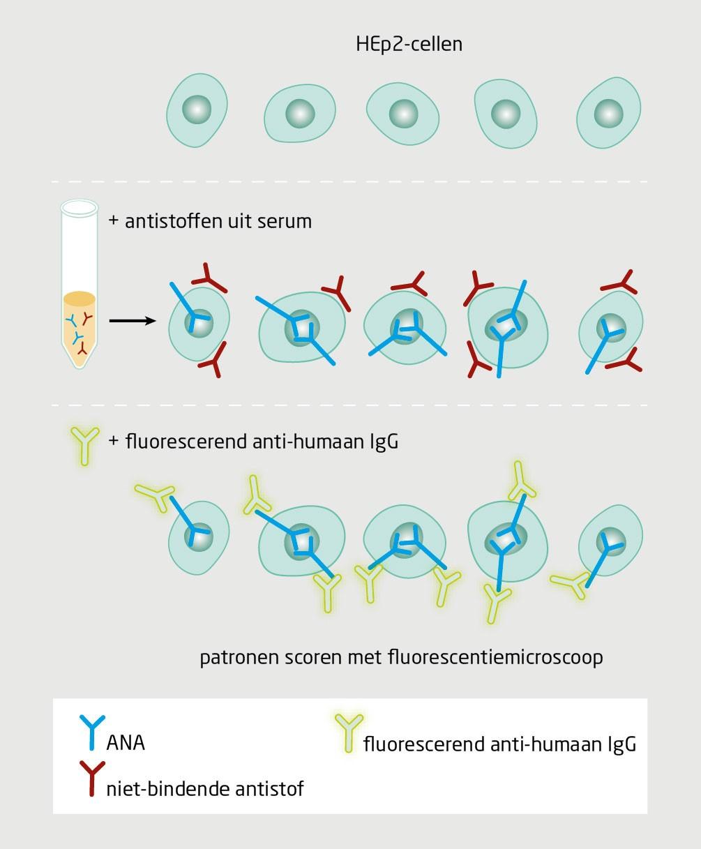 Figuur 1 | Indirecte immunofluorescentie met HEp-2-cellen