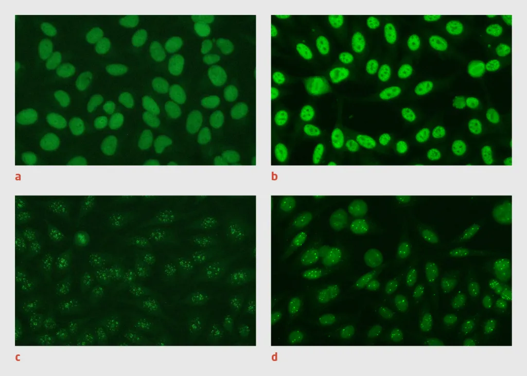 Figuur 2 | Fluorescentiepatronen van antinucleaire antistoffen