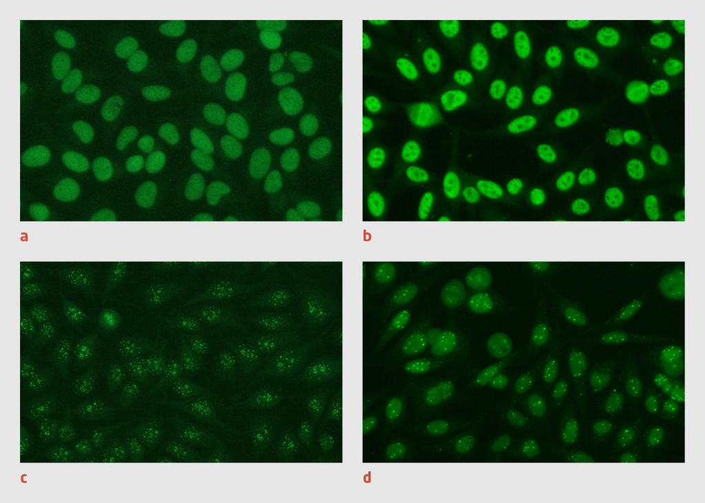 Figuur 2 | Fluorescentiepatronen van antinucleaire antistoffen